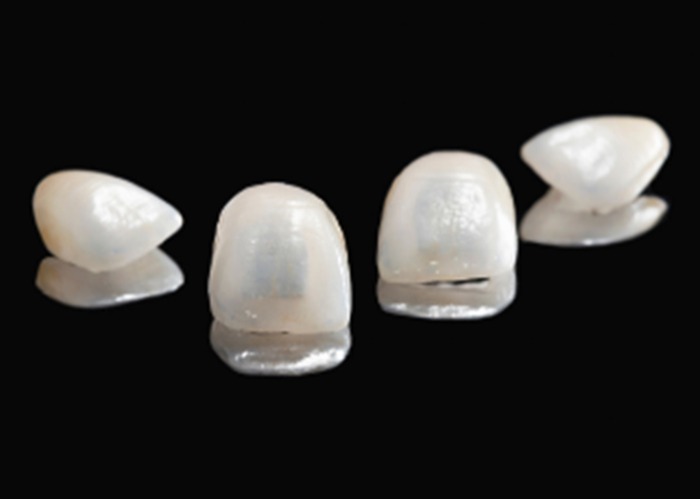 Alternatives to teeth straightening