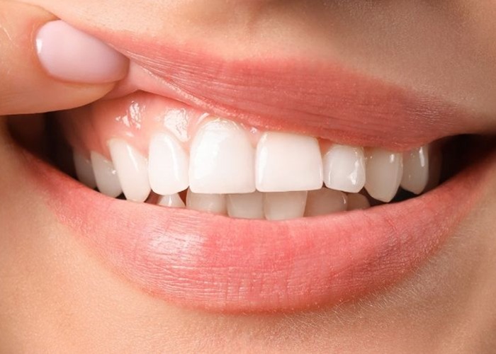 Healthy Gums and Jawbone