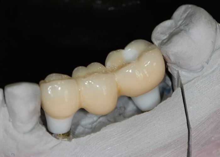 Alternative Treatment Solutions