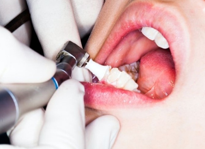 Maintaining Your Oral Hygiene