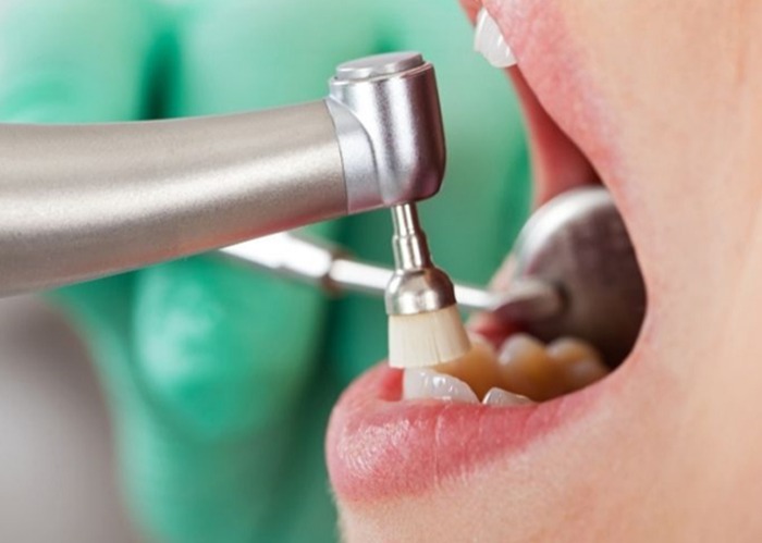 What to Expect During your Hygiene Appointment