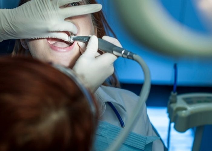 On the Day of Your Dental Filling Treatment
