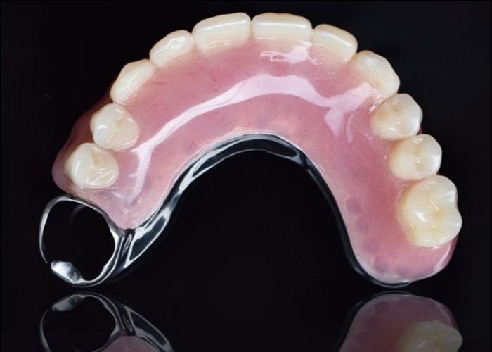 Types of dentures