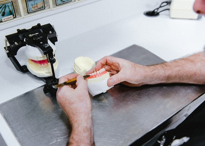 Disadvantages of dentures