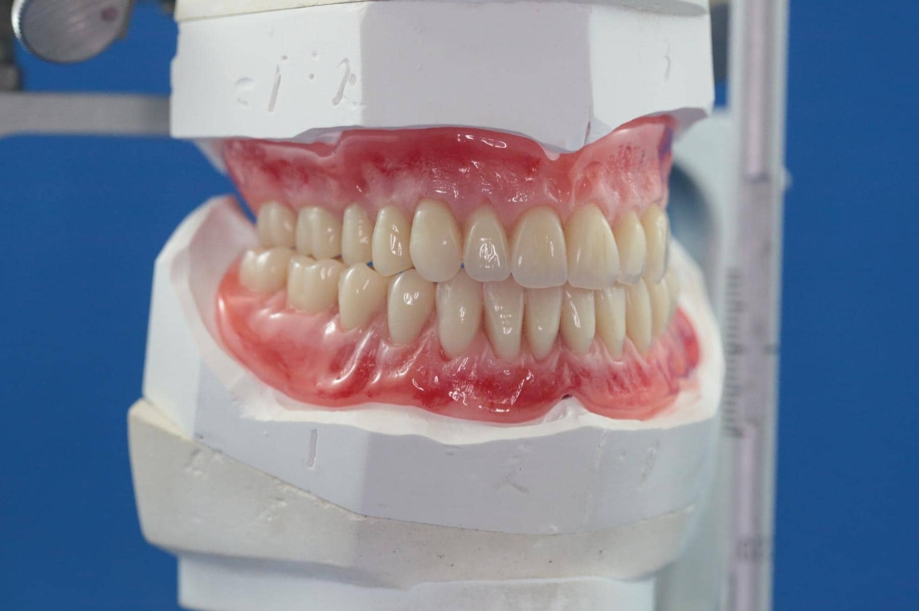 Dentures in Mount Lawley