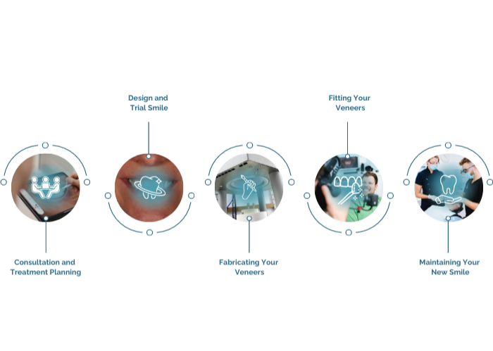 Porcelain Veneers Treatment Process
