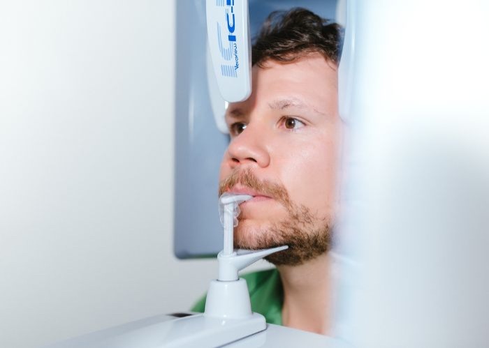 3D CBCT scan $212