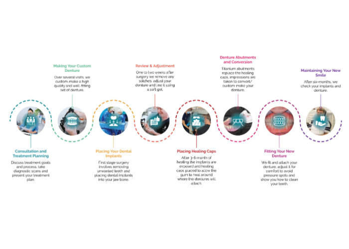 Implant-Retained Denture Process