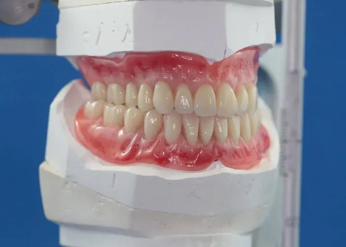 Dentures in Mount Lawley