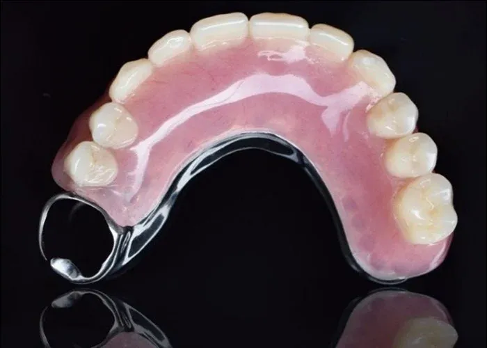 Types of dentures
