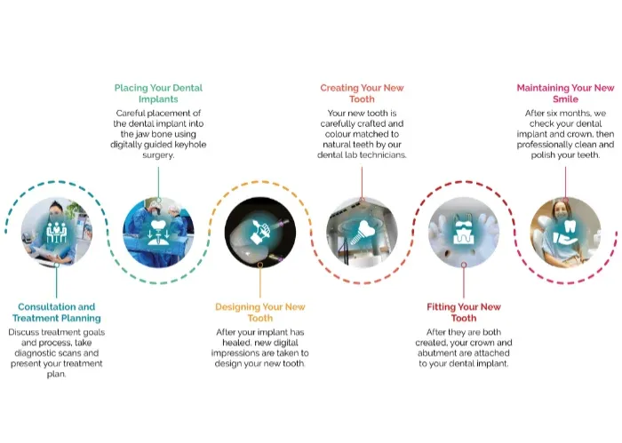 Single Dental Implant Process