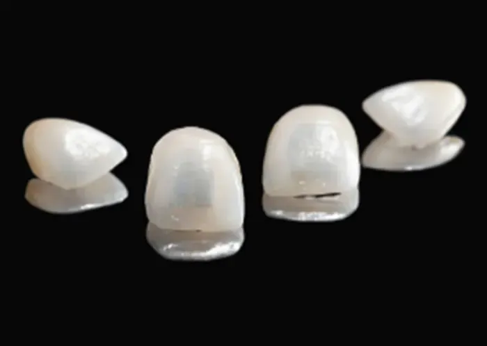 Alternatives to teeth straightening