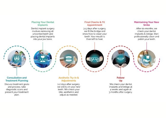 All-on-4® Treatment Process