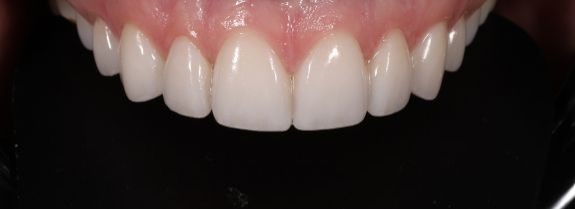 After Image