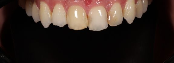 Before Image