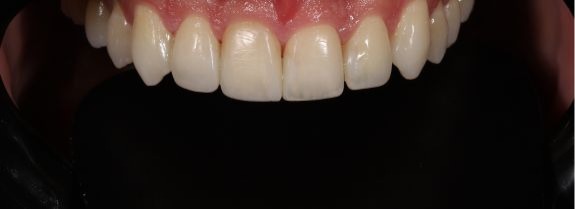 After Image