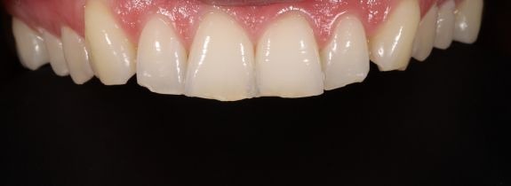 Before Image