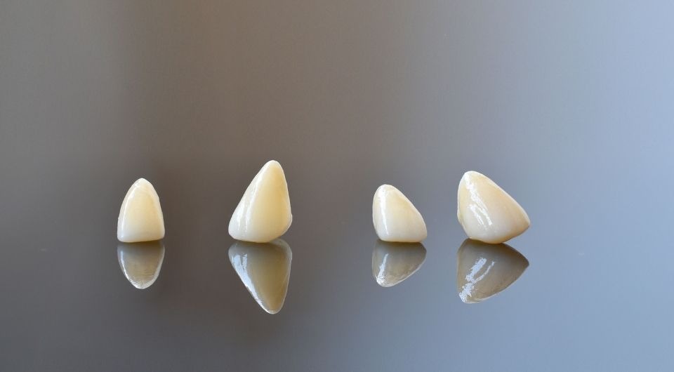 Veneers: Pros and Cons in 2021