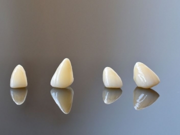 Veneers: Pros and Cons in 2021