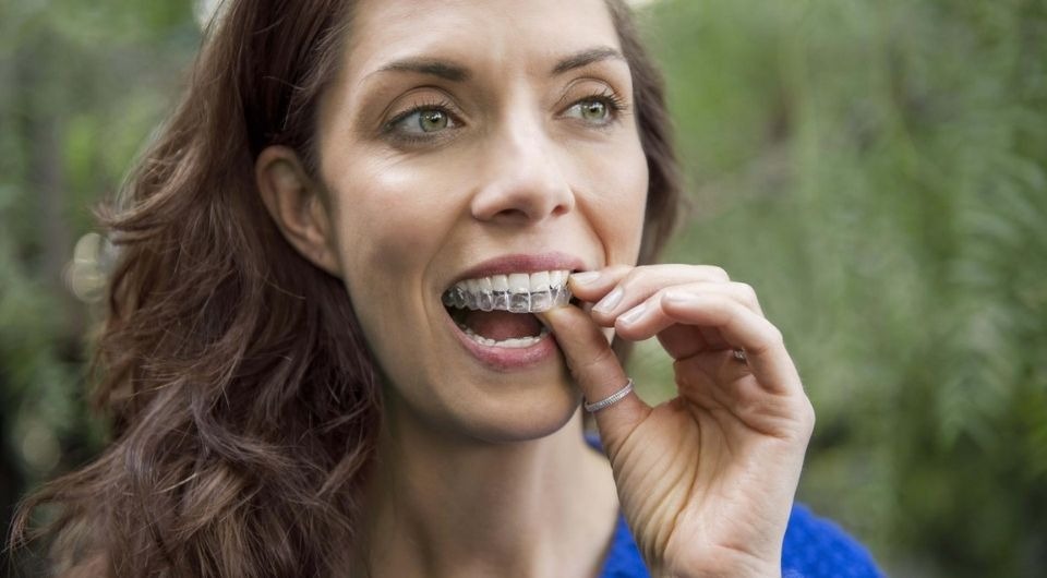 What's the Difference Between Invisalign® and Clear Aligners