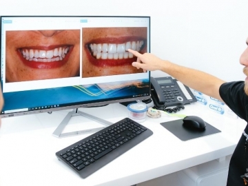 7 Ways to Cosmetically Enhance Your Smile