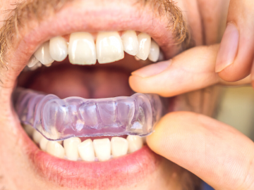 6 Reasons to Wear a Custom Mouthguard