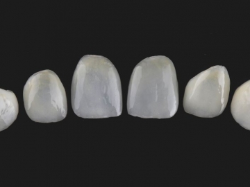 Types of Veneers and Costs