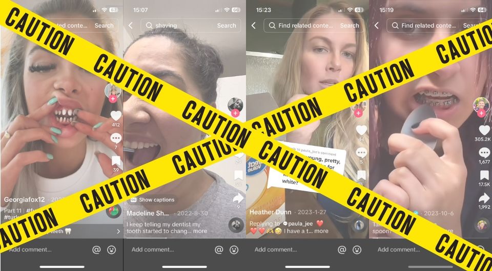 TikTok Hacks That Damage Teeth and Gums