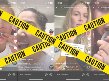 TikTok Hacks That Damage Teeth and Gums