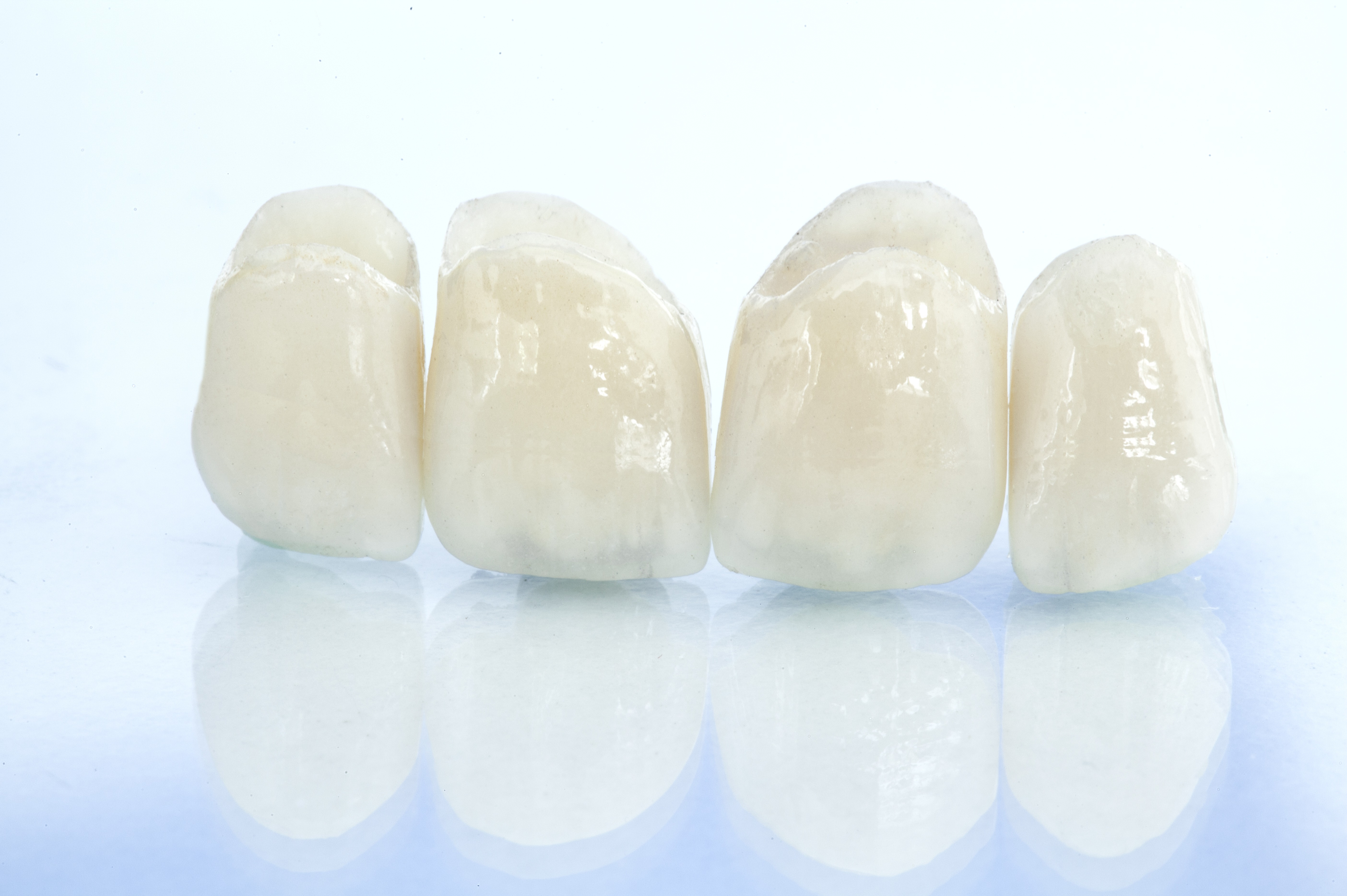 Dental Crowns: Costs and Longevity