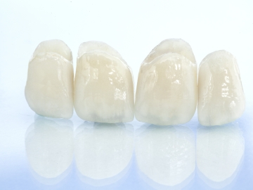 Dental Crowns: Costs and Longevity
