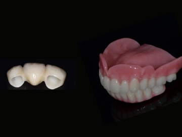 Bridges or Dentures: What’s Right for You