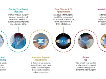 From Consult to Smile: The All-on-4® Journey