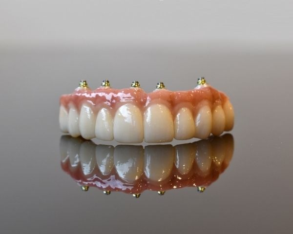 Dental Implants