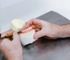 Dentures