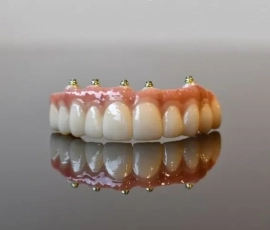 Dental Implants